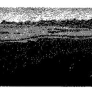 BACIA-DOS-AFOGADOS-CEU-4